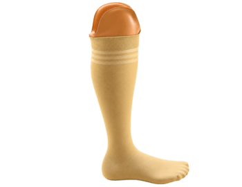 Prosthetic Example 2